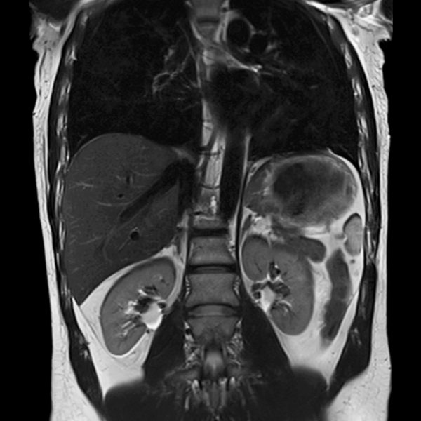 medlife rmn 3 tesla medlife rmn 3 tesla